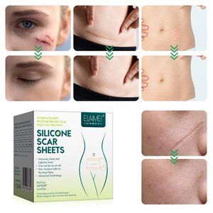 Scar Removal Silicone Tape for Hypertrophic Scars & Keloids, 1.6'' x 120''